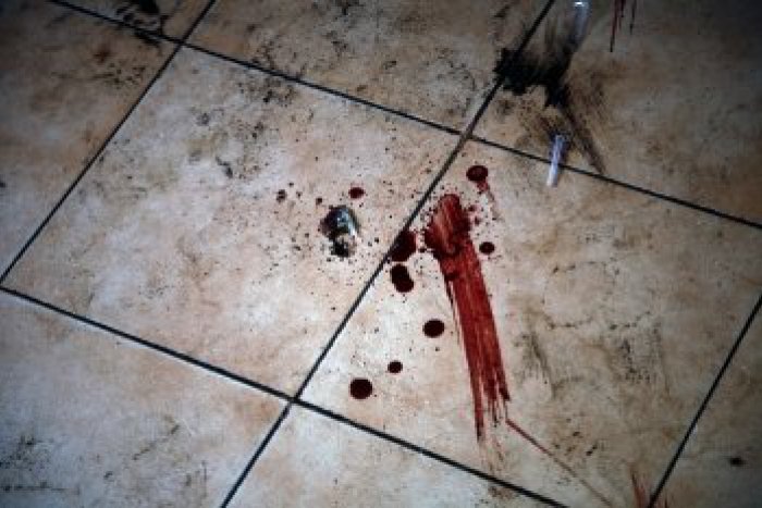Ilustračný obrázok k článku Horná Ves na nohách: Muž (51) zbil ženu do krvi, svokru postrelil!