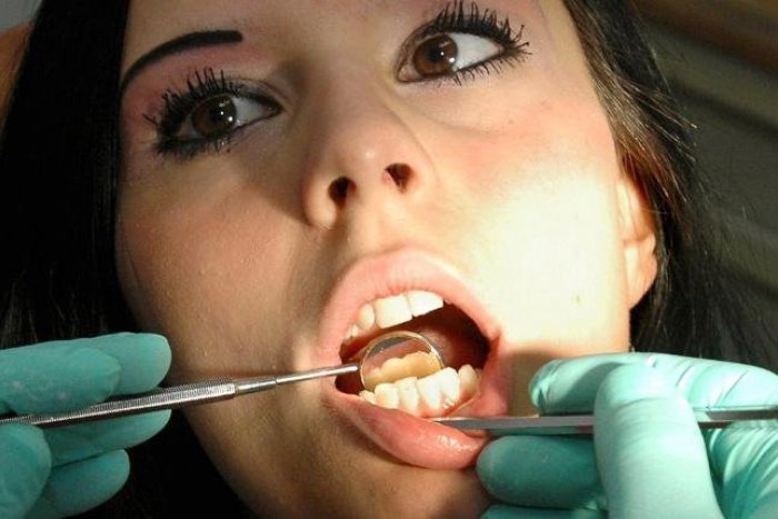 Ilustračný obrázok k článku Vyše 40 % Slovákov nebolo nikdy u dentálnej hygieničky