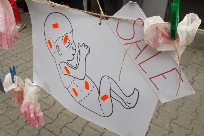 Ilustračný obrázok k článku Protest proti obchodovaniu s orgánmi nenarodených detí podporilo niekoľko desiatok ľudí i politikov