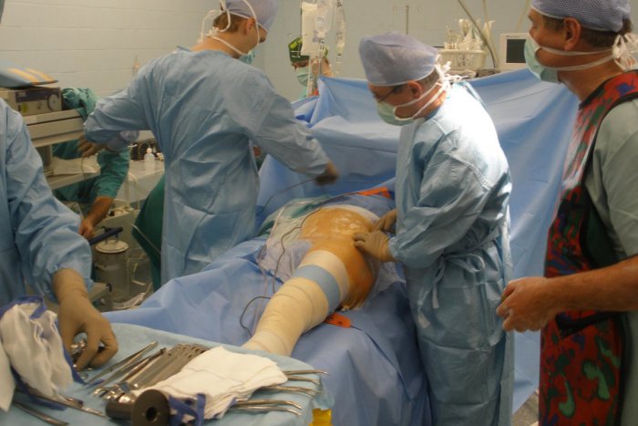 Ilustračný obrázok k článku Pacientovi museli po operácii na falošnej plastickej klinike amputovať nohu