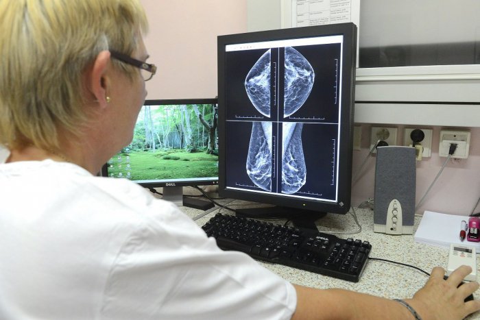 Ilustračný obrázok k článku Kežmarská nemocnica pozýva ženy na preventívne vyšetrenia: Istota je istota!