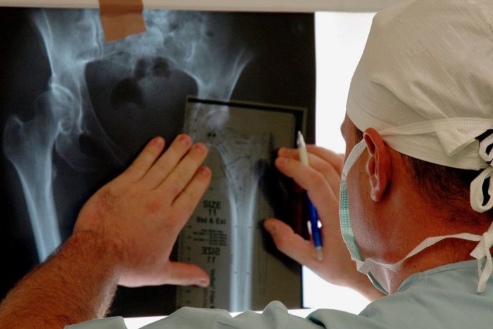 Ilustračný obrázok k článku Trápia vás poškodené kĺbové chrupavky? Lekári ich vedia liečiť vďaka bunkám pacienta