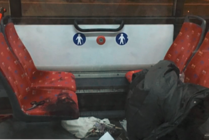 Ilustračný obrázok k článku V bratislavskom autobuse MHD zachraňovali ženu obliatu kyselinou