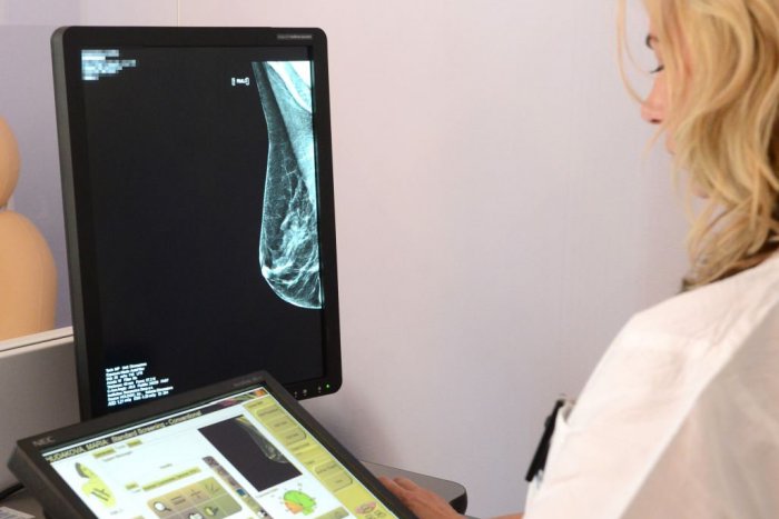 Ilustračný obrázok k článku Ocenili mamografické pracovisko v Nitre: Ročne tu vyšetria zhruba 7000 žien