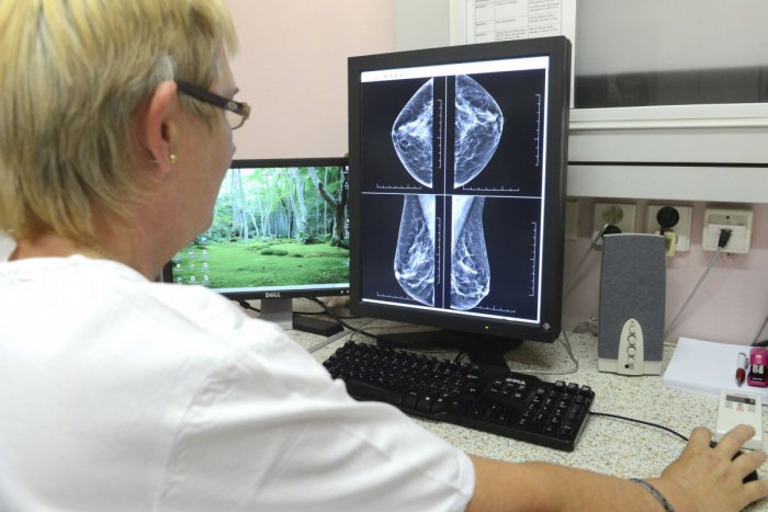Ilustračný obrázok k článku Na mamografiu do Levíc: Pacientky zo Zlatých Moraviec budú vyšetrené prednostne