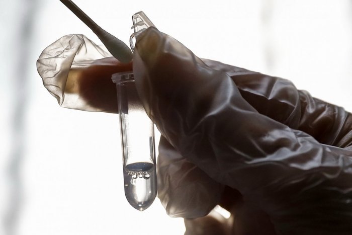 Ilustračný obrázok k článku Koronavírus na Slovensku: Stúpol počet testov i nakazených v kritickom veku