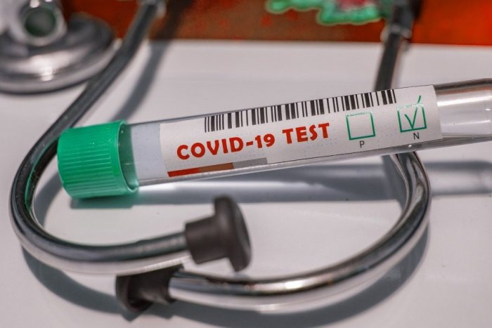 Ilustračný obrázok k článku Pozitívny testovaný na koronavírus je v Trnave! Na Slovensku sú pritom len dvaja