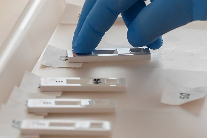 Ilustračný obrázok k článku Župa distribuuje antigénové testy ambulantným lekárom: Vydala ich už 55-tisíc