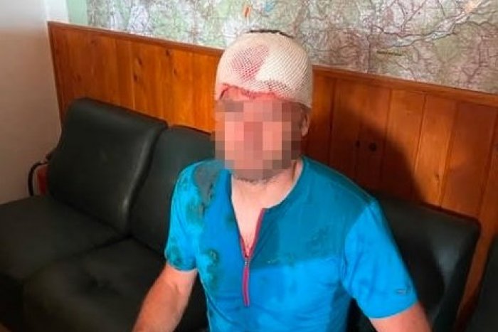 Ilustračný obrázok k článku Ďalší útok MEDVEĎA na Slovensku: Zranil horského záchranára, pomoc volal zo stromu