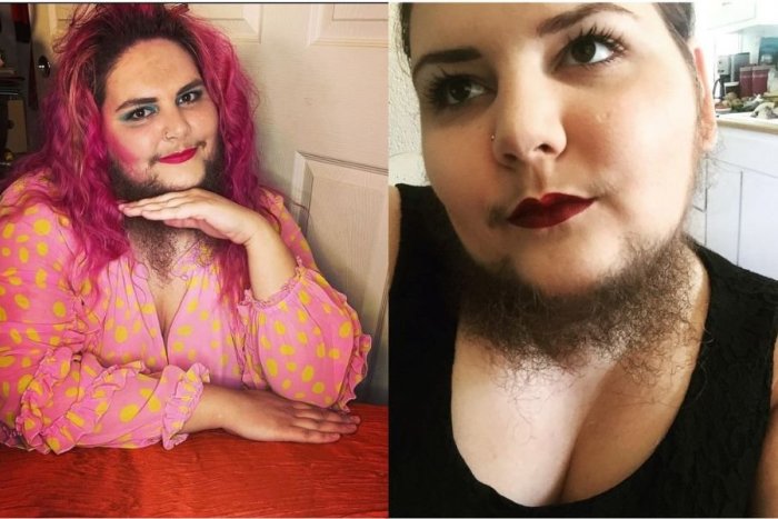 Ilustračný obrázok k článku Mávala komplexy, dnes je na seba pyšná: Bradatá žena sa cíti SEXY a je hviezdou šou