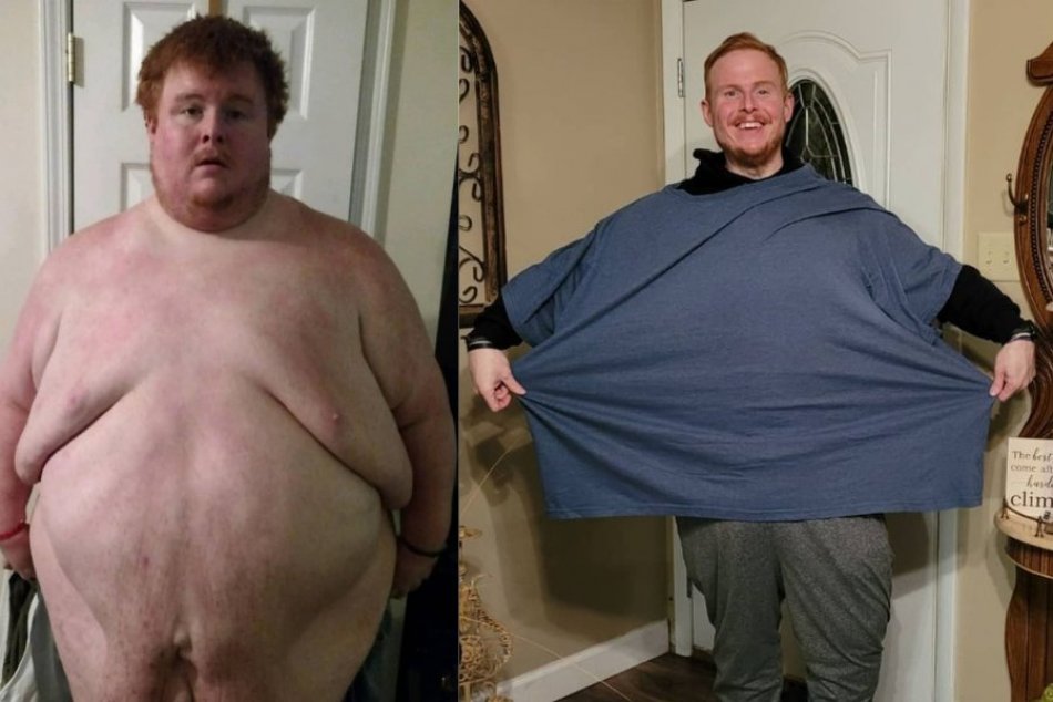 Ilustračný obrázok k článku EXTRÉMNE obézny muž sa kvôli nadváhe zasekol v sprche: Začal makať a zhodil 270 kilogramov