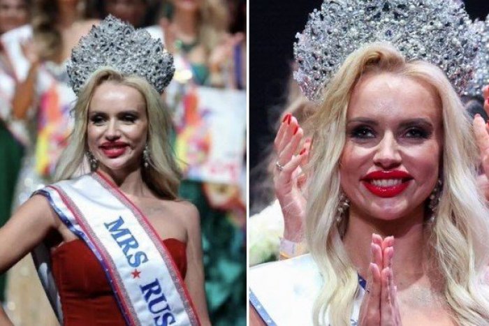 Ilustračný obrázok k článku Ruská kráľovná krásy je ľuďom na smiech: Botoxová HRÔZA, odkazujú blondínke