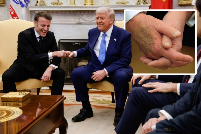 Ilustračný obrázok k článku Trump má na ruke OBROVSKÚ modrinu: Šialené, ako to vysvetlil Biely dom!