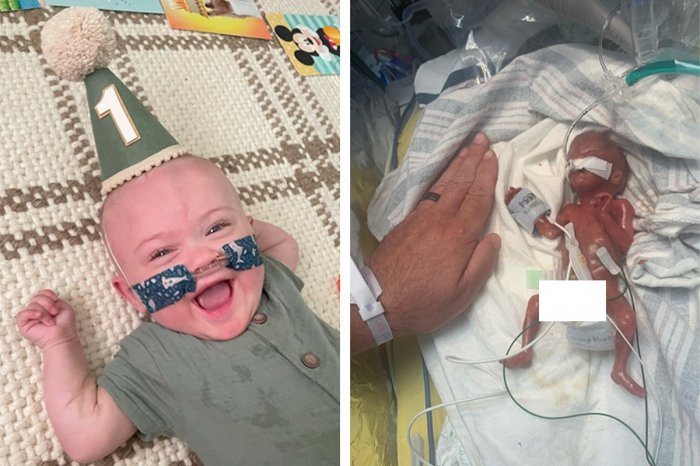 Ilustračný obrázok k článku Nedávali mu ŽIADNU šancu! Chlapček mal pri narodení 285 g: Oslávil PRVÉ narodeniny