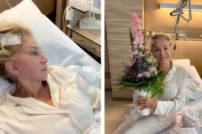 Ilustračný obrázok k článku Carmen Geiss podstúpila operáciu MOZGU! V hlave má platničku a skrutky