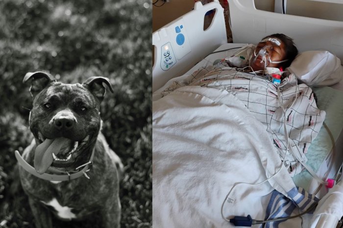 Ilustračný obrázok k článku Pitbul strhol ženu z bicykla: BRUTÁLNY útok! Museli jej AMPUTOVAŤ obe ruky aj nohy