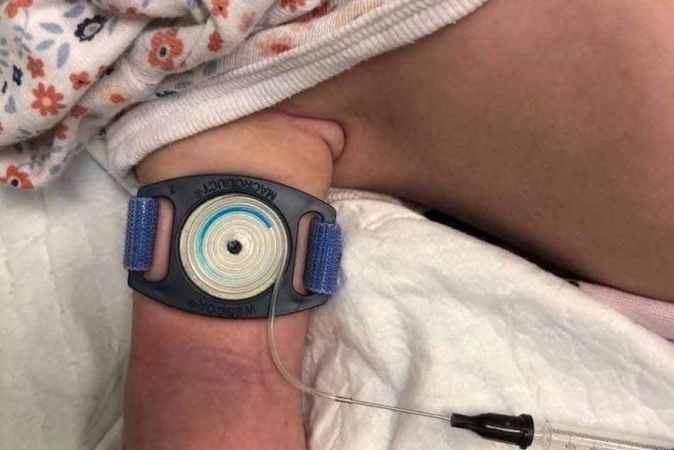 V OBRAZOCH: Detská nemocnica má nový prístroj na diagnostiku cystickej fibrózy